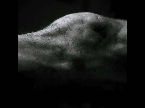 The body check