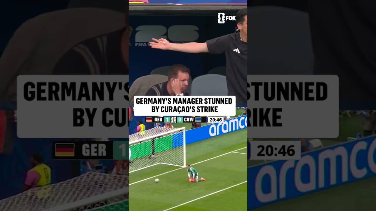 NAGELSMANN IS STUNNED 😳
