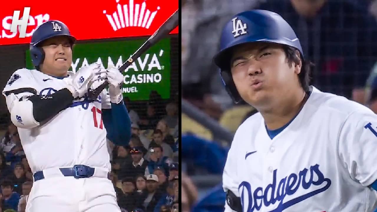 Shohei Ohtani Gets HIT in the Hand 😳