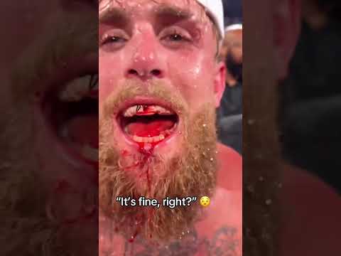 Jake Paul’s jaw 😳 (via jakepaul/TT)