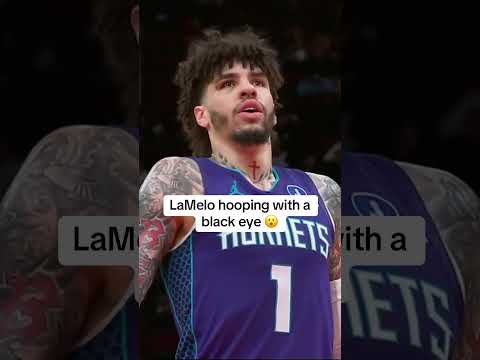 Could you tell LaMelo Ball has a black eye? 😦