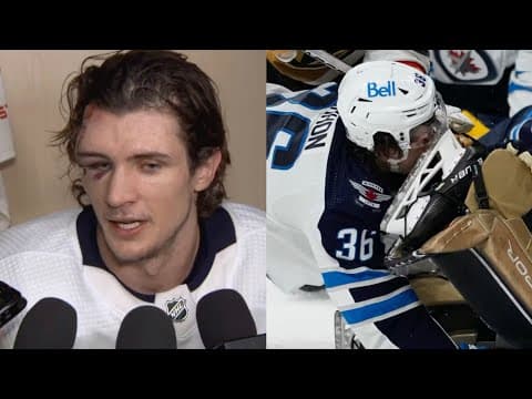 NHL Visible Injuries During Interviews