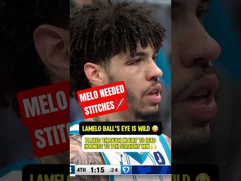 LaMelo played through a rough eye injury to lead the Hornets comeback. 💪