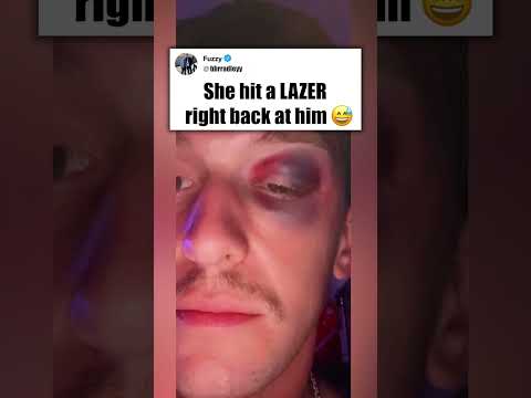 she gave him a black eye 😲