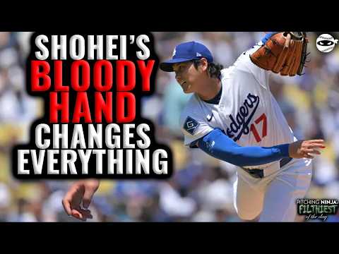 Should Shohei Ohtani take a break from Pitching?
