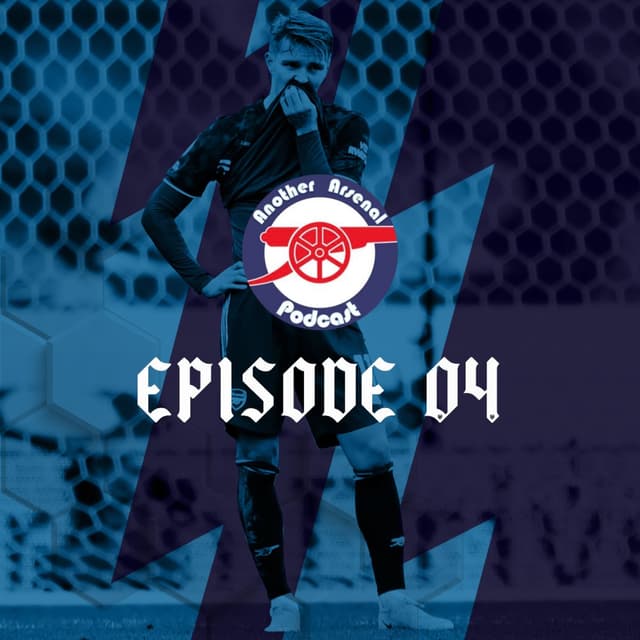 Losing (Again), Looking to Leeds and Losing Limbs.